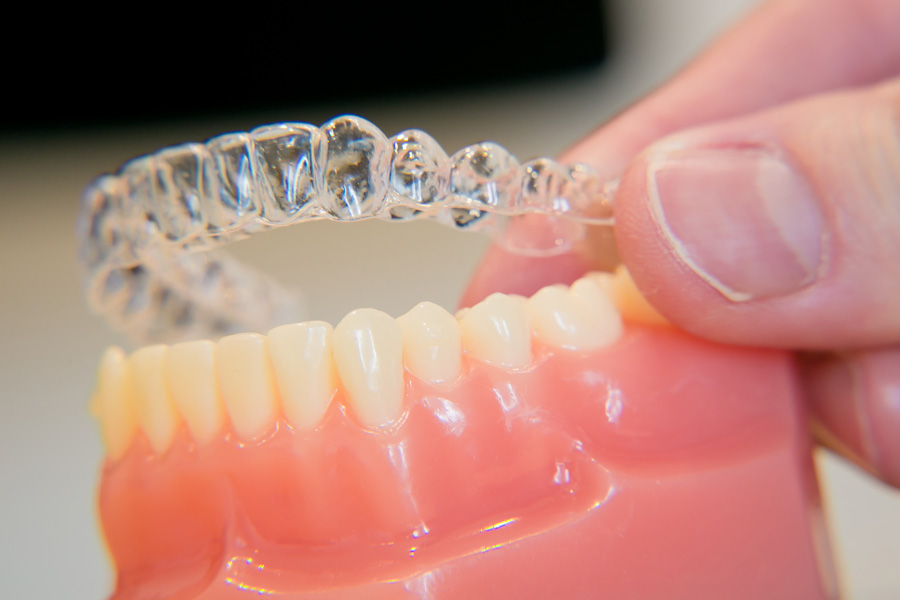 ジョイスマイル矯正歯科のマウスピース型矯正装置（インビザライン）